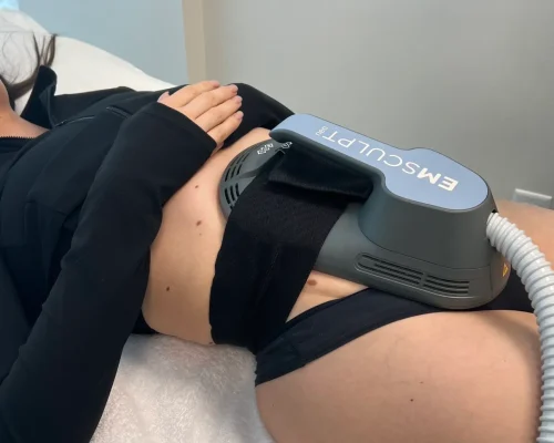 Emsculpt-NEO-Side-Effects