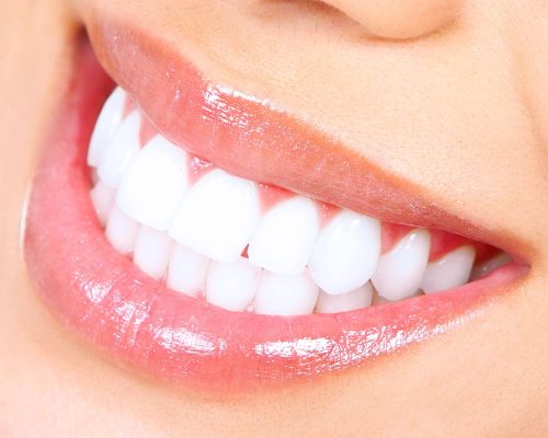 Teeth-Whitening.jpg.optimal